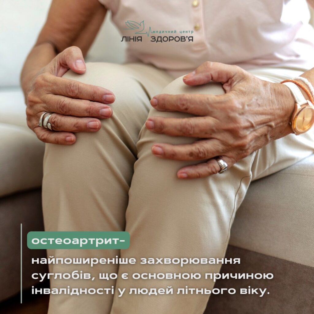 Лікування остеоартриту - Медичний центр "Лінія здоров'я"