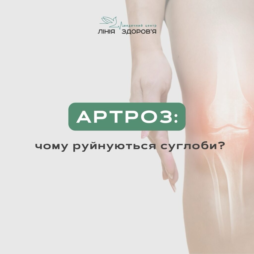 Артроз - Медичний центр "Лінія здоров'я"