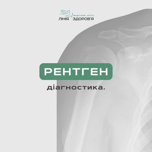 Рентген - Медичний центр "Лінія здоров'я"