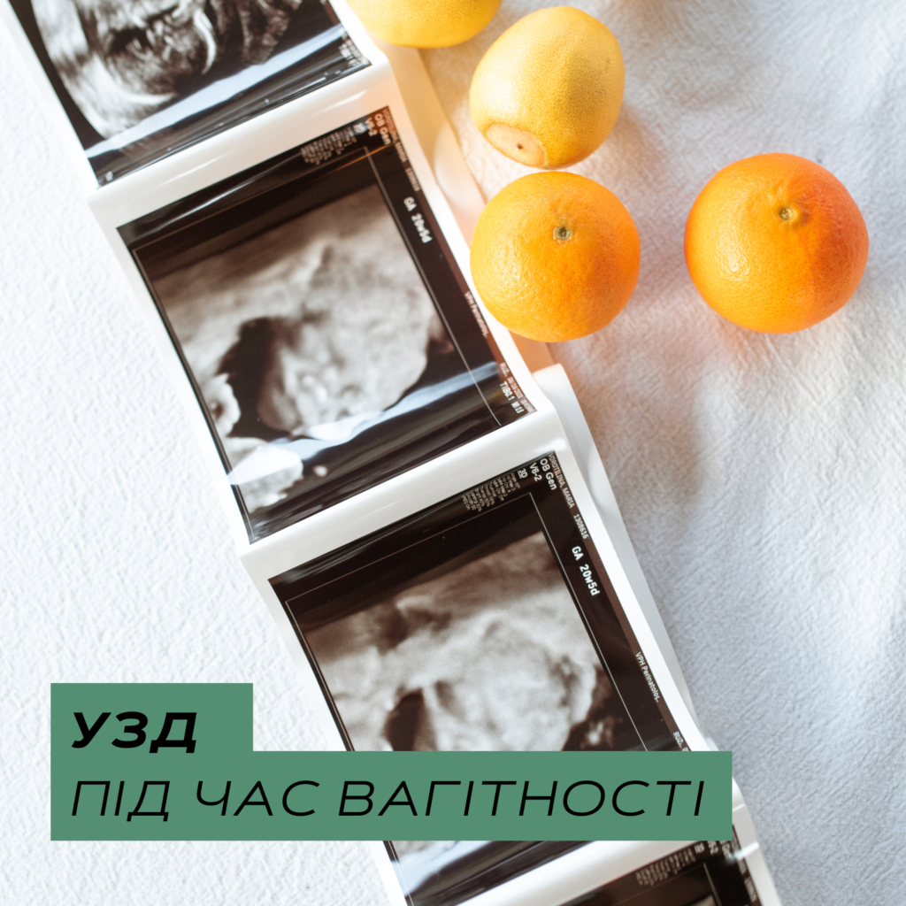 УЗД під час вагітності - Медичний центр "Лінія здоров'я"